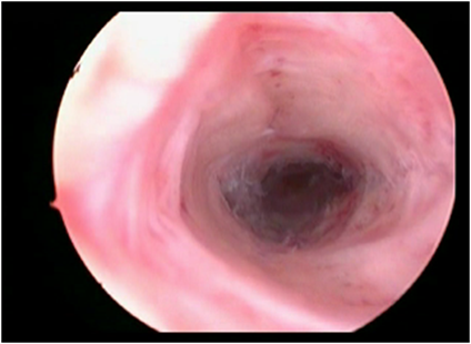 ashermanbeforeoperation