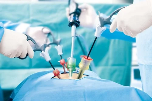 hysteroscopy & laparoscopic surgeries